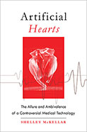 McKellar Artificial Hearts